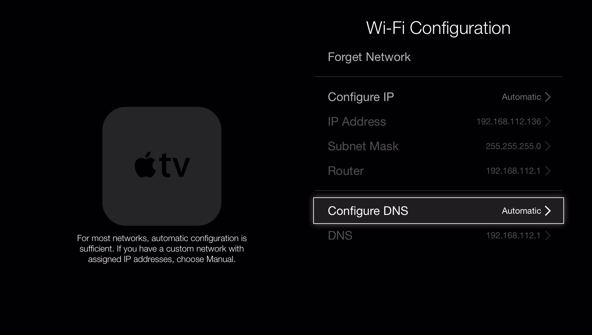 configure dns setting in apple tv