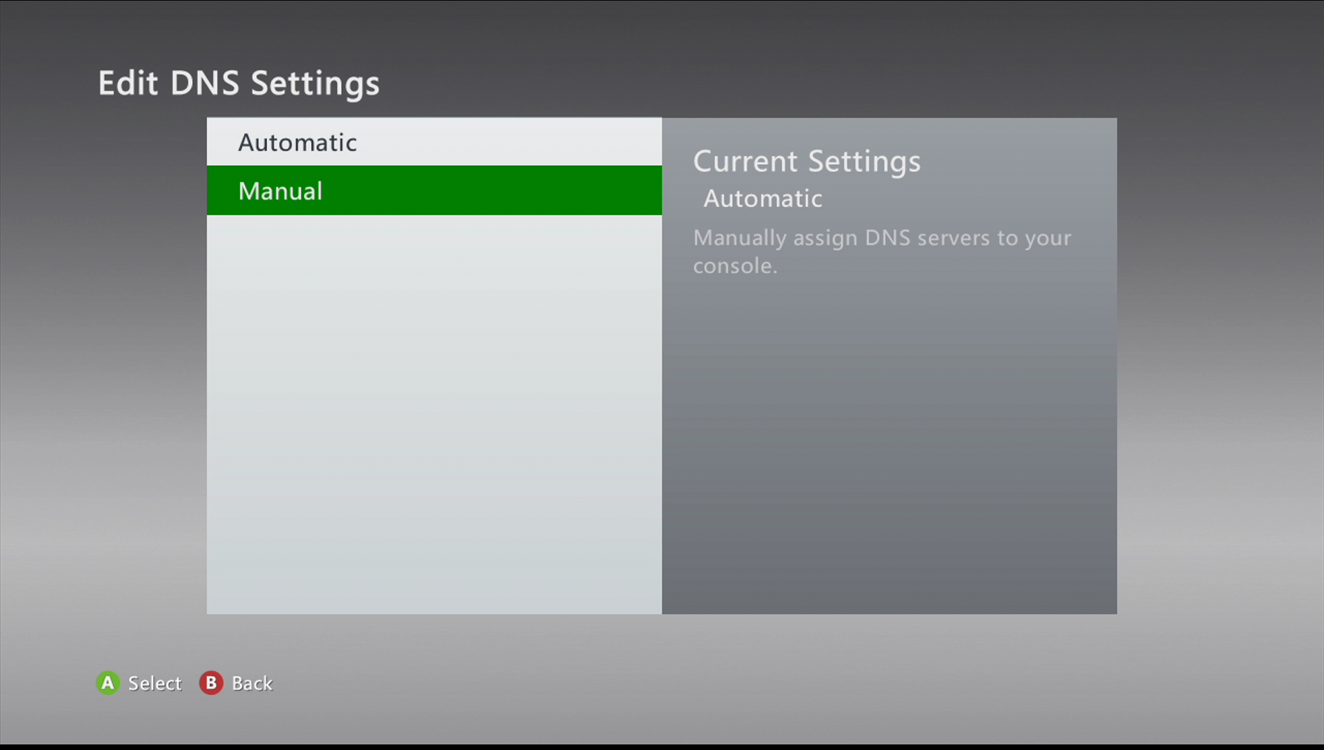 xbox 360 enter dns manually