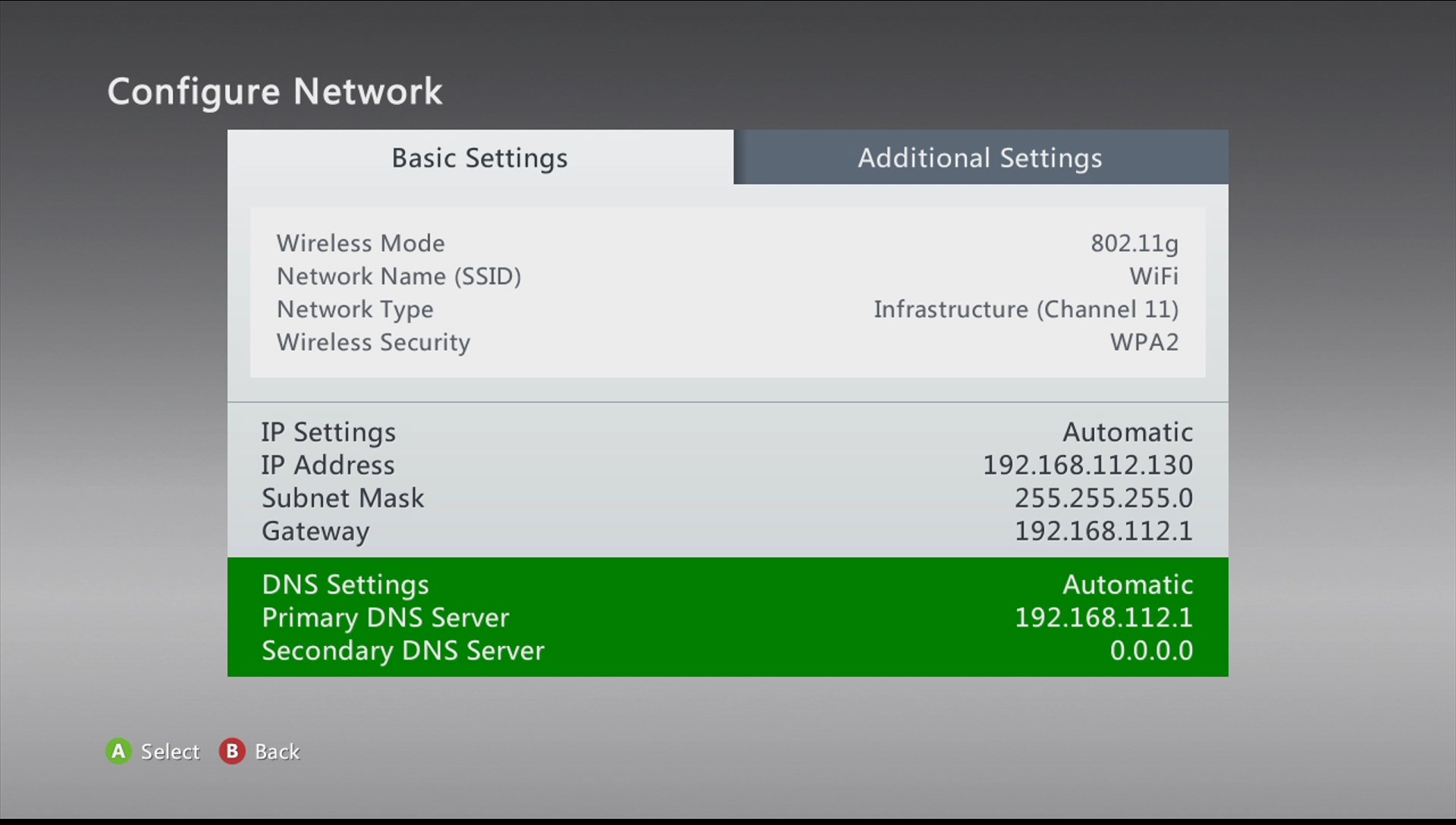 xbox 360 select dns settings